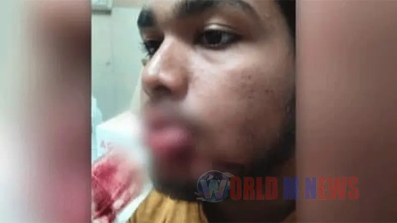 ട്രെയിനിൽ നിന്നും പ്ലാറ്റ്ഫോമിലേക്ക് എറിഞ്ഞ കുപ്പി മുഖത്തു കൊണ്ടു ; വിദ്യാർത്ഥിയുടെ രണ്ട് പല്ല് പോയി, മുഖത്ത് സാരമായ പരിക്ക്