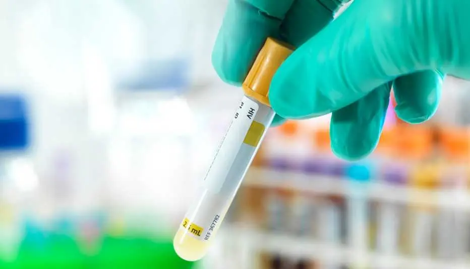 HIVയെ നിയന്ത്രിക്കാൻ പുതിയ വഴി; നിർണായക കണ്ടെത്തലുമായി ശാസ്ത്രലോകം