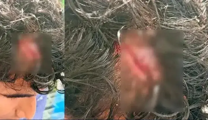 റാഗിങ്ങ്  : പ്ലസ് വണ്‍ വിദ്യാര്‍ത്ഥിയുടെ തല കുത്തിപ്പൊട്ടിച്ച  ആറ് വിദ്യാർത്ഥികളെ സസ്പെന്‍ഡ് ചെയ്തു