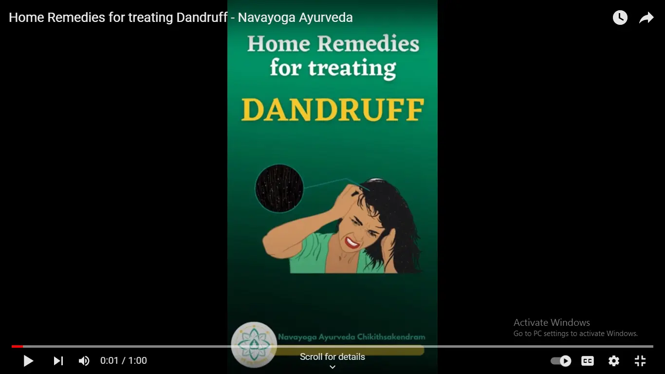 Home Remedies for treating Dandruff