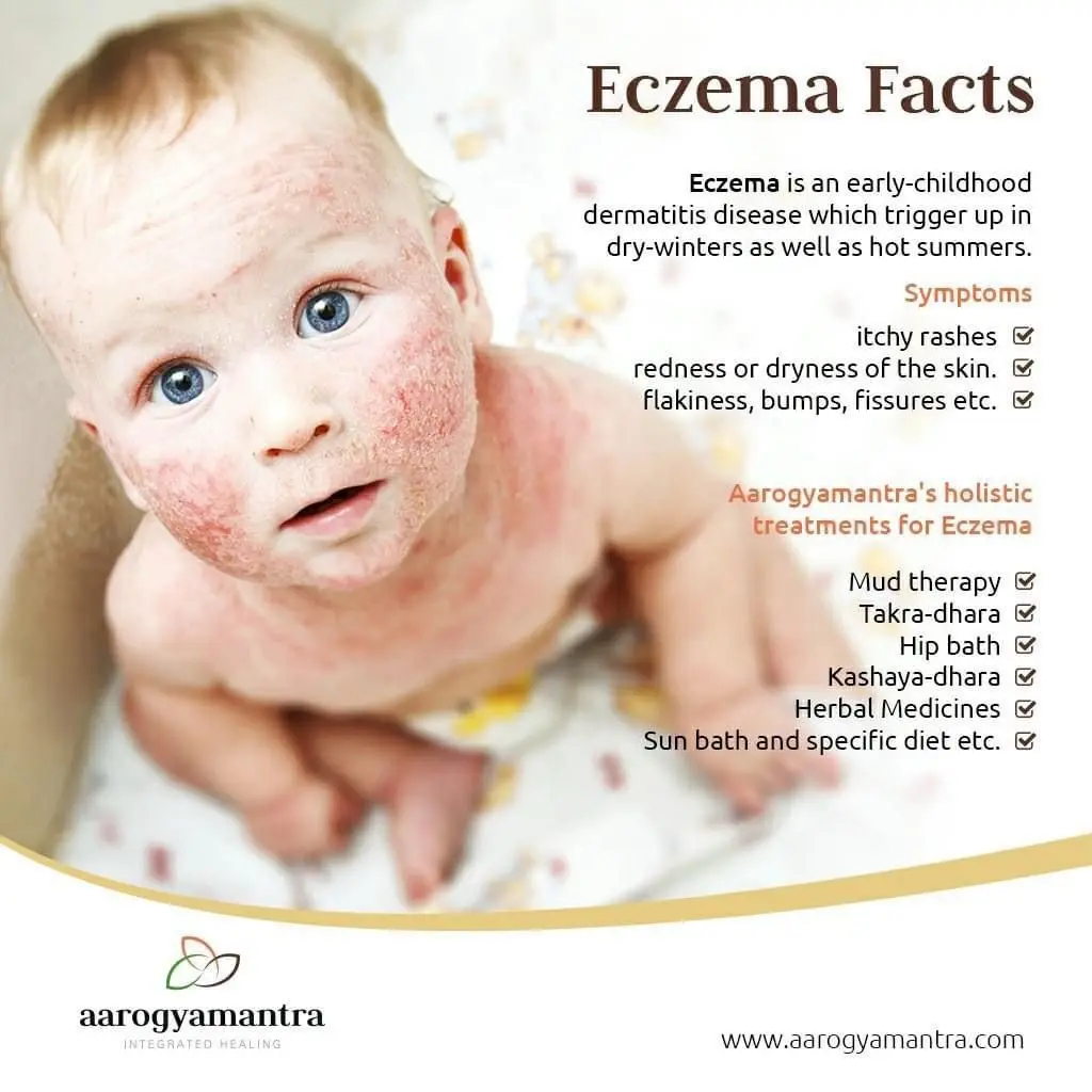 Struggling with Eczema? 